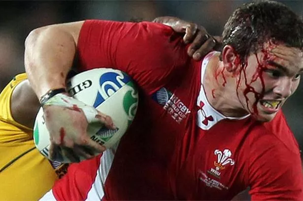 a-bloodied-george-north-battles-on-717275187.jpg