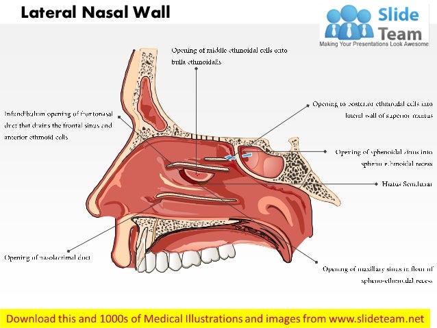 lateral-nasal-wall-medical-images-for-power-point-1-638.jpg