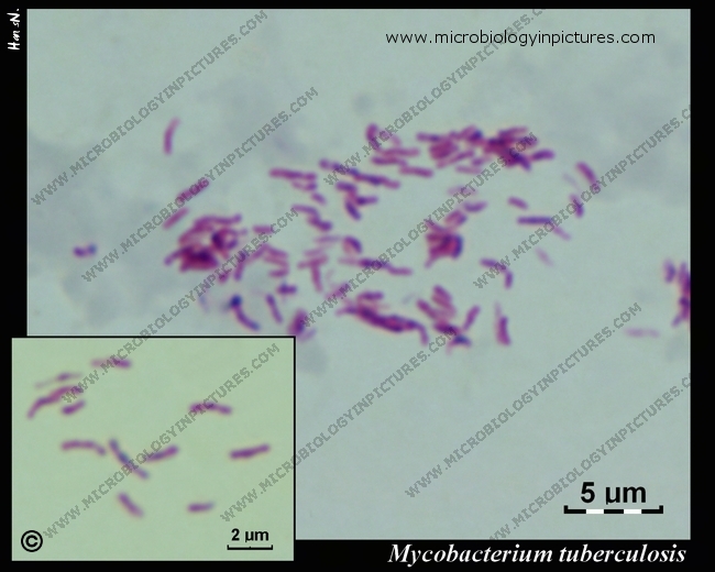 mycobacterium%20tuberculosis%20026.jpg