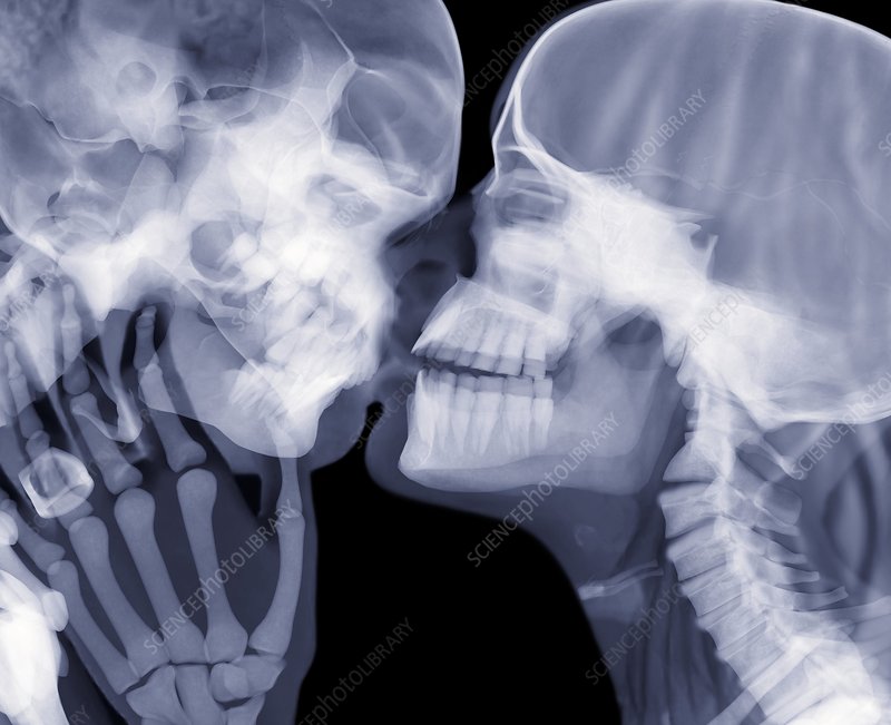 C0115767-Lovers_kissing,_X-ray-SPL.jpg