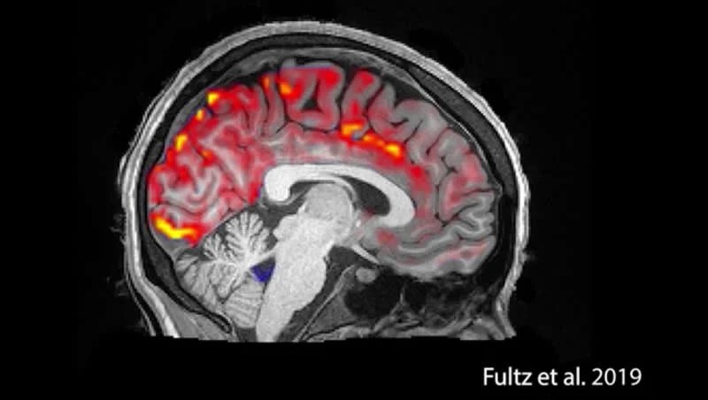 cerebrospinal-fluid-sleep-neurosciencenews.jpg