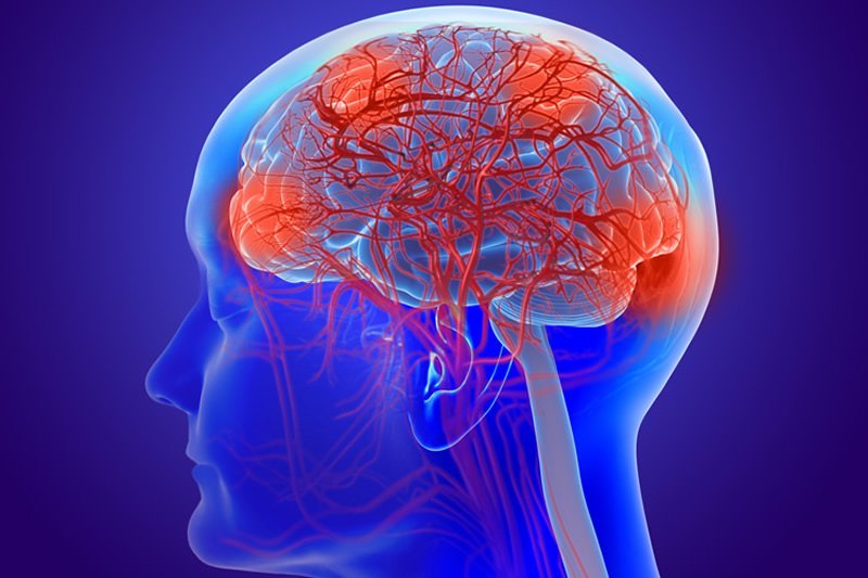 inflammation-reversed-dementia-neurosciencenews.jpg
