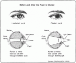 dilated.gif