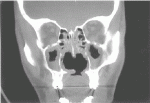 figure2a.gif