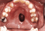 figure3a.gif