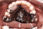 figure3c.gif