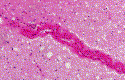 fig2.gif