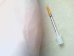 my arm.jpg