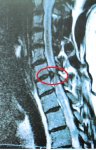 mri.jpeg