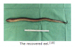 eel2.PNG