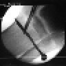 IronLung_AK