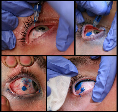 eyeball-tattoo-1.jpg