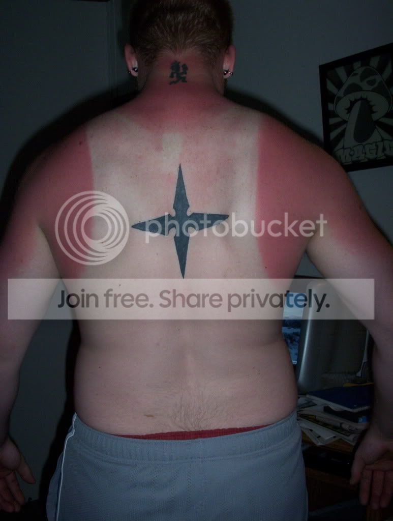 2CE2CDSunburn.jpg
