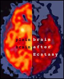 brain-xtc1.jpg