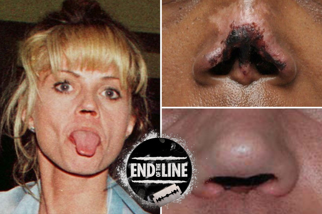 KH-COMPOSITE-COKE-NOSE-v2.jpg