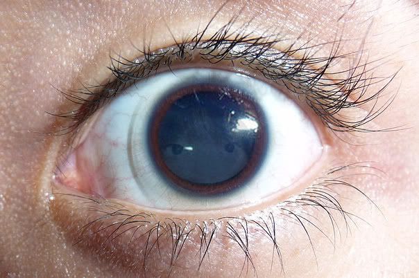 Eye.jpg