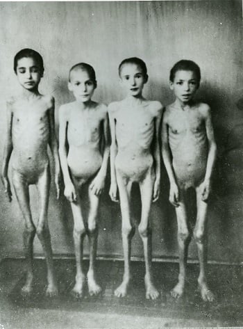 child-victims-of-pseudo-medical-experiments.jpg