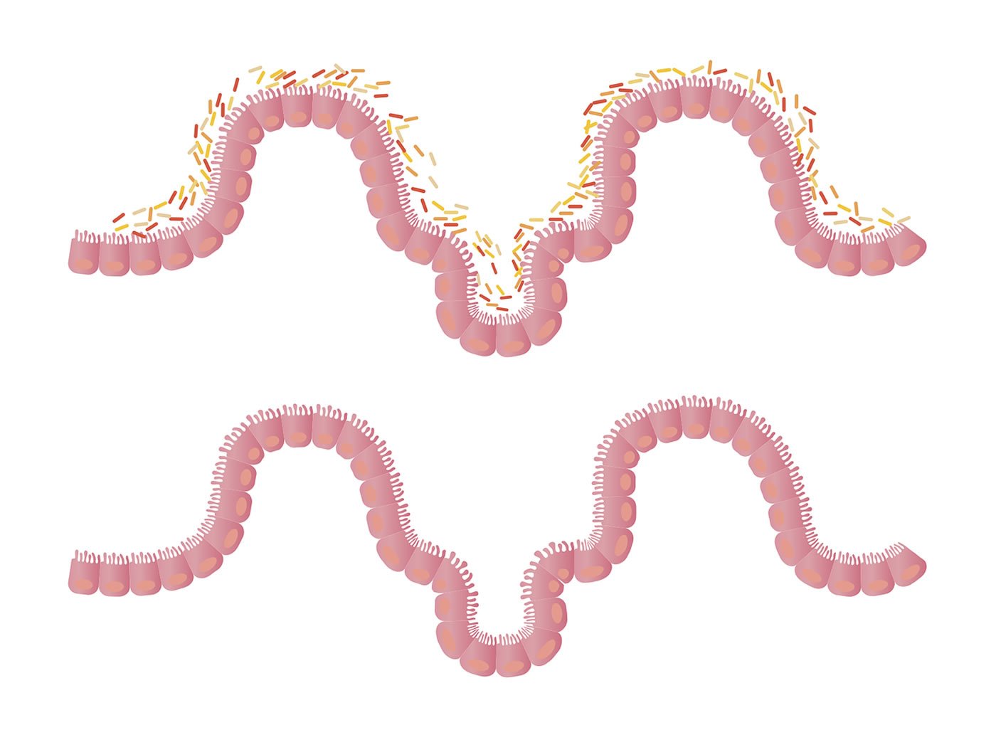 als-microbiome-neuroscneews-public.jpg