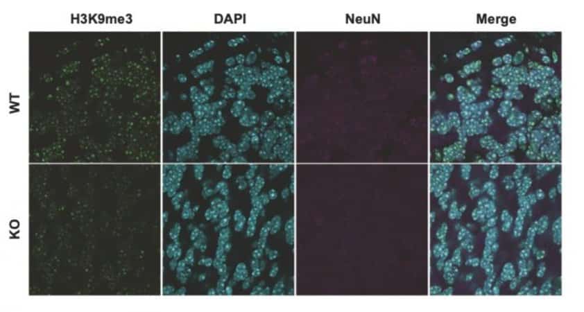 asd-genetic-link-neurosicences.jpg