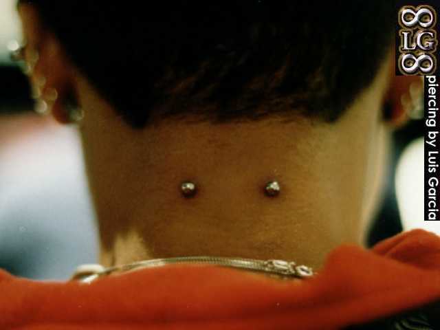 nape2.jpg