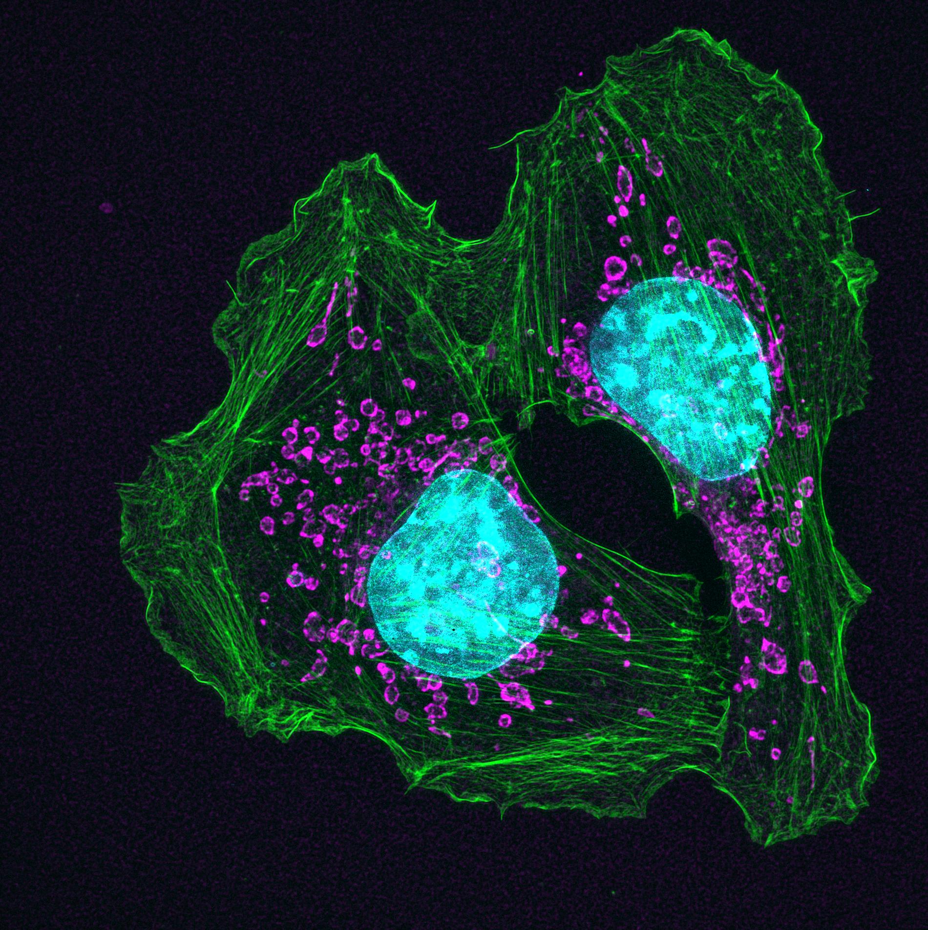Cancer_skin_credit_flickr-Zeiss.jpg