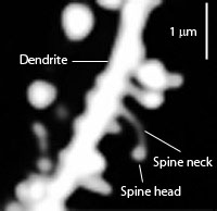 Dendritic_spines.jpg