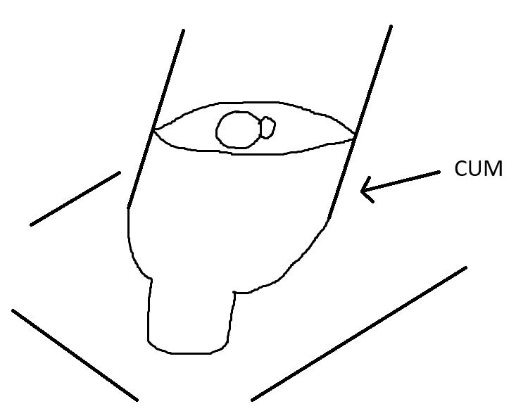 bottle.png