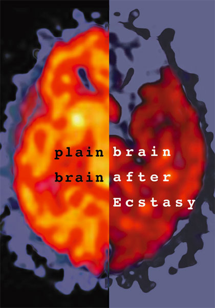 ecstasy-brain.jpg