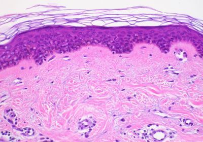 skin-tissue-s.jpg