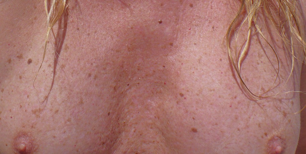 3052676149_58034a1698_b.jpg