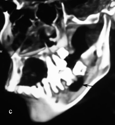 CT3D.jpg