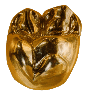 dental_gold_crown1.gif