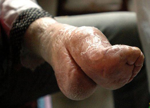 Chinese-Foot-Binding-Olt-Timer-Close-Up.jpg