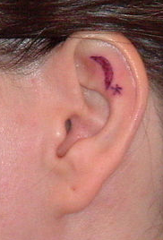 TattooedAttachedEarlobe.png