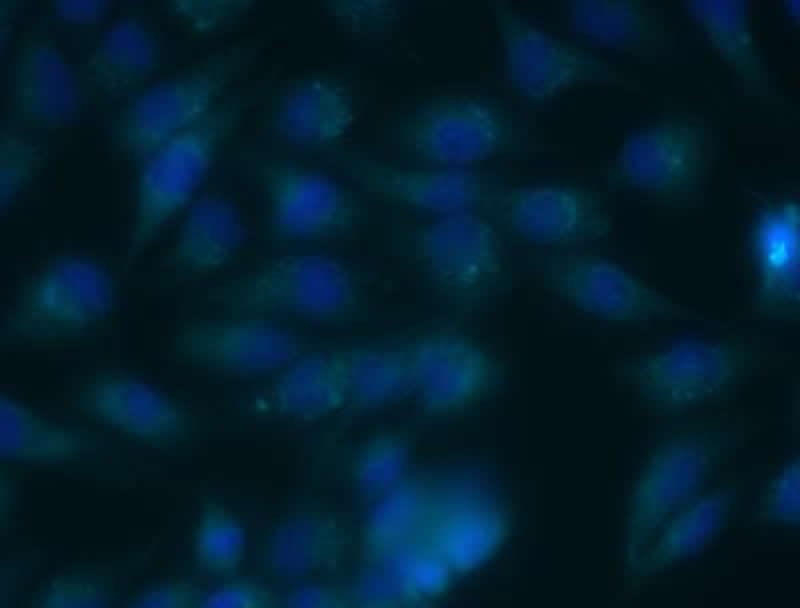 neurosciencenews.com