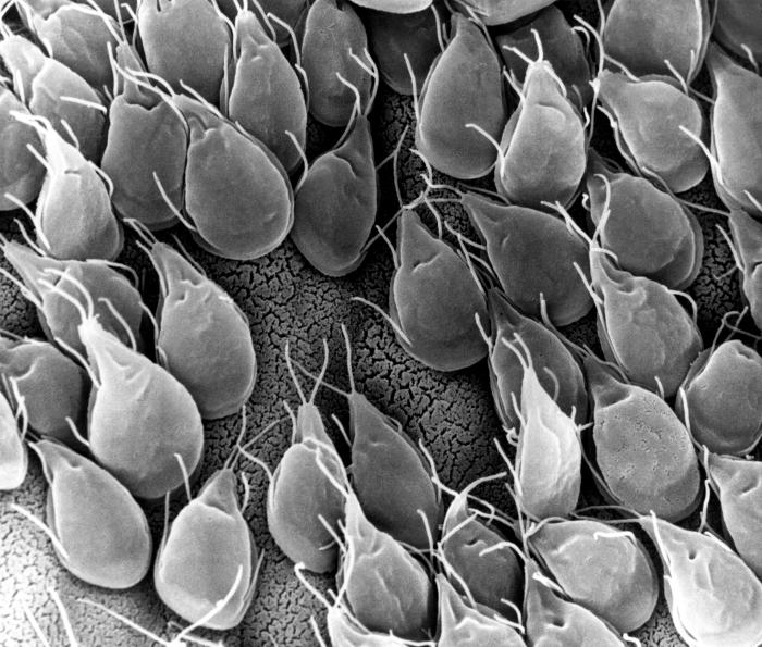 Giardia-spp.--infected--gerbil-intestine.jpg