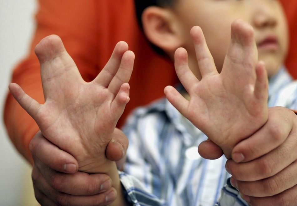 chilling-images-human-mutation-across-world.jpg