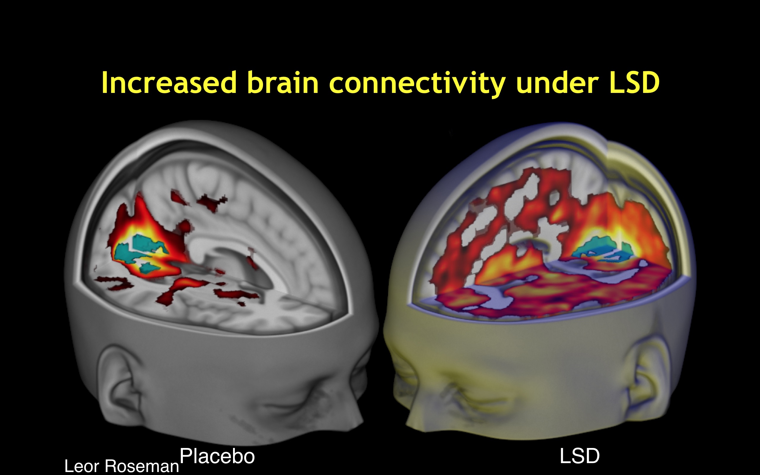 Beckley-LSD-research.jpg