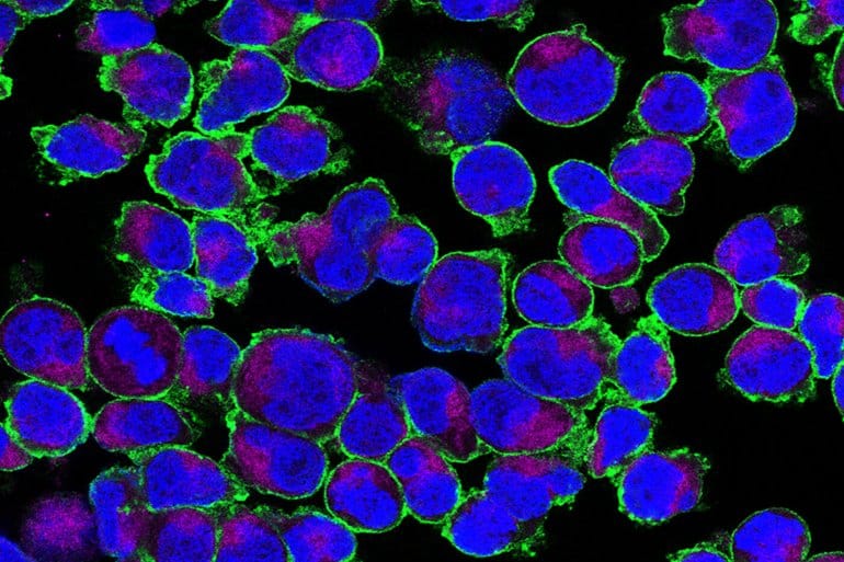 sugar-inflammation-neurosicencce-.jpg