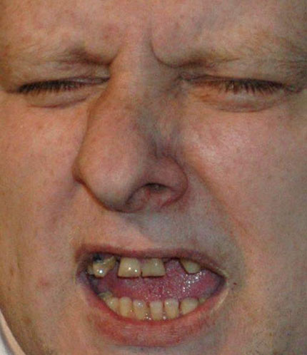 7700052_shaunryder-before.jpg