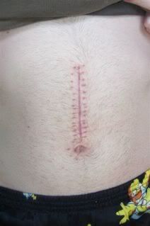 leighszipper.jpg