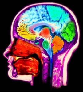 brain-mri.jpg