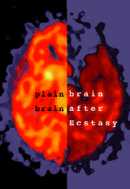 mdma_nida_brainscans1_sm.jpg