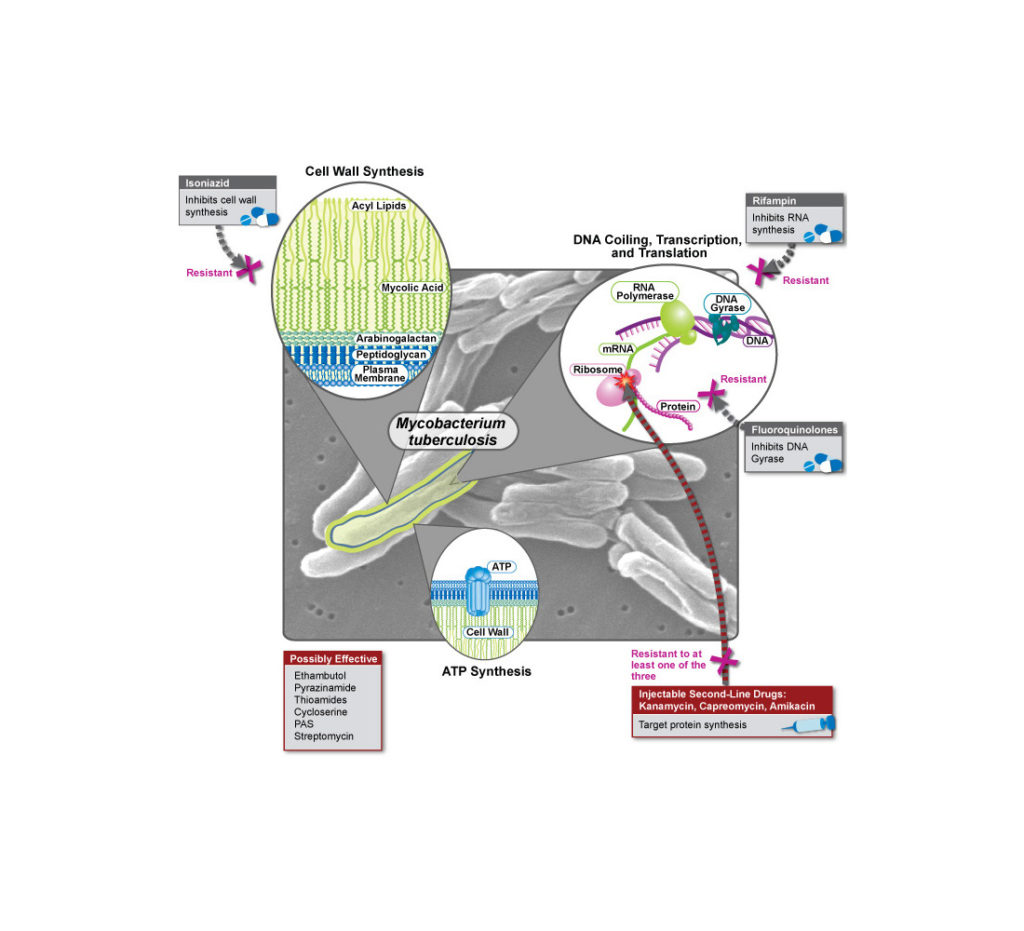 Extensively-drug-resistant-TB--1024x931.jpg