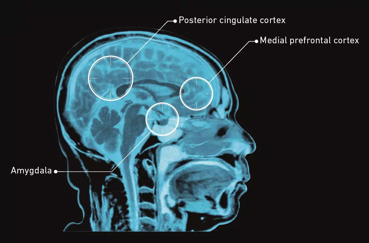 Psilocybin-fig-1-2.jpg