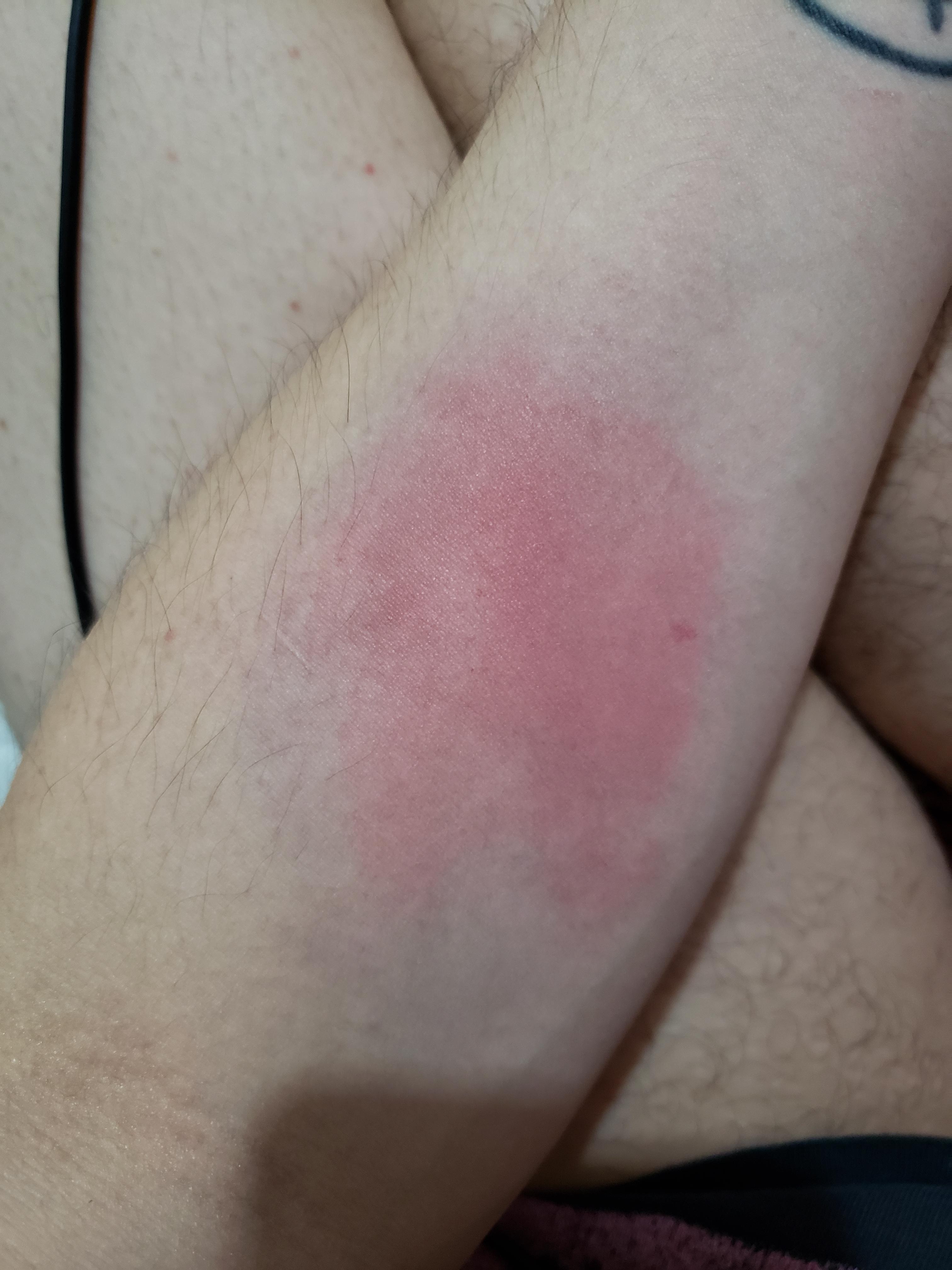 Yls8Mdg.jpg
