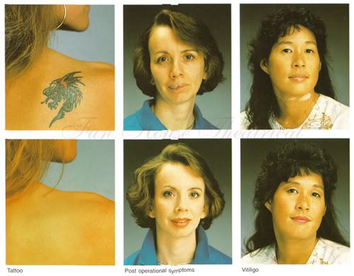 dermacolor_tattoo.jpg