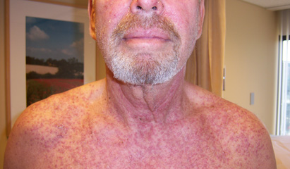 www.oncologynurseadvisor.com