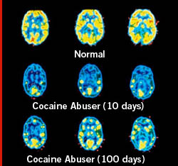 brain1.jpg