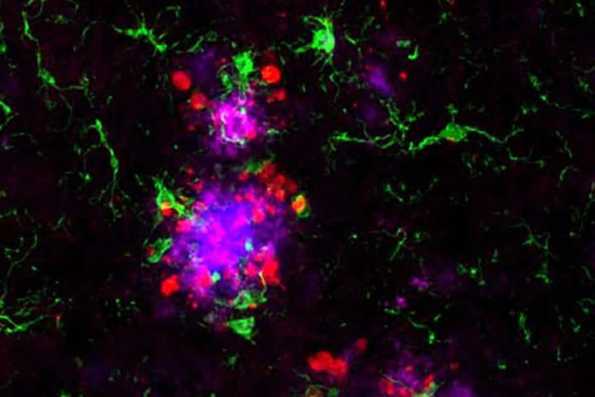 neurosciencenews.com